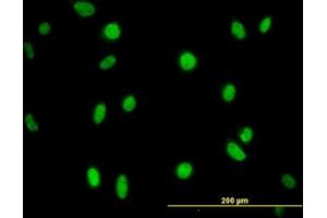 Image no. 1 for anti-N-Methylpurine-DNA Glycosylase (MPG) (AA 1-90) antibody (ABIN598819) (MPG 抗体  (AA 1-90))