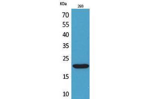 Western Blotting (WB) image for anti-CKLF-Like MARVEL Transmembrane Domain Containing 6 (CMTM6) (C-Term) antibody (ABIN3178338) (CMTM6 抗体  (C-Term))