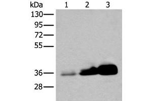 Western blot analysis of Human testis tissue NIH/3T3 and 231 cell lysates using UBE2Z Polyclonal Antibody at dilution of 1:350 (UBE2Z 抗体)