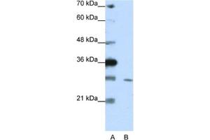 Western Blotting (WB) image for anti-Zinc Finger Protein 397 (ZNF397) antibody (ABIN2461947) (ZNF397 抗体)