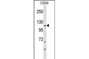 KIT Antibody (Ascites) ABIN1539990 western blot analysis in CEM cell line lysates (35 μg/lane). (KIT 抗体)