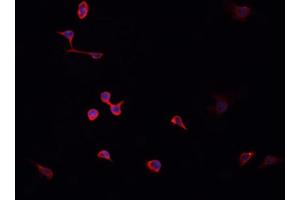 ABIN6268820 staining HeLa cells by IF/ICC. (HNRNPA2B1 抗体  (N-Term))