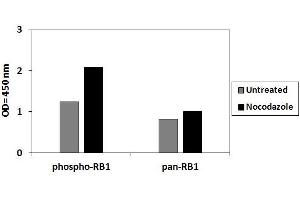 Retinoblastoma 1 ELISA 试剂盒