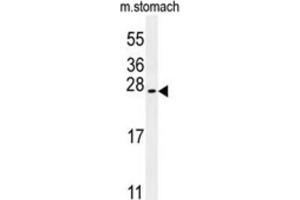 Western Blotting (WB) image for anti-Dynein, Cytoplasmic 2, Heavy Chain 1 (DYNC2H1) antibody (ABIN3002490) (DYNC2H1 抗体)
