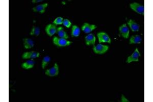 Immunofluorescence staining of A549 cells with ABIN7158410 at 1:66, counter-stained with DAPI. (LIPH 抗体  (AA 175-325))