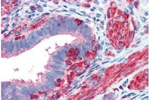 Human Uterus (formalin-fixed, paraffin-embedded) stained with ACTB antibody ABIN337261 at 5 ug/ml followed by biotinylated goat anti-rabbit IgG secondary antibody ABIN481713, alkaline phosphatase-streptavidin and chromogen. (beta Actin 抗体  (N-Term))