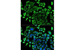 Immunofluorescence analysis of U2OS cells using T antibody (ABIN6131955, ABIN6148795, ABIN6148796 and ABIN6221421). (TAB1 抗体  (AA 205-504))