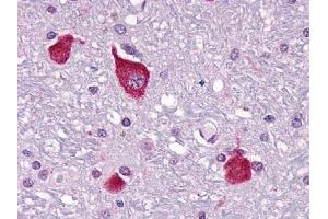 Immunohistochemical staining of Brain (Neurons and glia) using anti- PTHR2 antibody ABIN122363 (PTH2R 抗体  (C-Term))