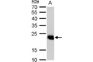 WB Image RAB6A antibody detects RAB6A protein by western blot analysis. (RAB6A 抗体)