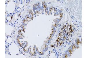 Immunohistochemistry of paraffin-embedded rat lung using RARA antibody. (Retinoic Acid Receptor alpha 抗体)