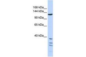 Image no. 1 for anti-Tankyrase, TRF1-Interacting Ankyrin-Related ADP-Ribose Polymerase (TNKS) (AA 1079-1128) antibody (ABIN6740351) (TNKS 抗体  (AA 1079-1128))