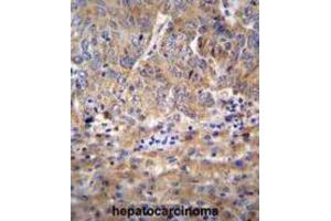 Immunohistochemistry (IHC) image for anti-Family with Sequence Similarity 212, Member B (FAM212B) antibody (ABIN2996391) (FAM212B 抗体)