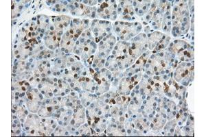 Immunohistochemical staining of paraffin-embedded Human Kidney tissue using anti-BDH2 mouse monoclonal antibody. (BDH2 抗体)