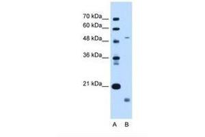 Image no. 1 for anti-Zinc Metalloproteinase, Ste24 (Zmpste24) (AA 83-132) antibody (ABIN6738260) (ZMPSTE24 抗体  (AA 83-132))