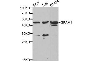 Western blot analysis of extracts of various cell lines, using SPAM1 antibody. (SPAM1 抗体  (AA 100-300))