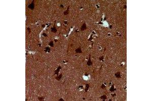 Immunohistochemical analysis of Alpha-synuclein (pY125) staining in human brain formalin fixed paraffin embedded tissue section. (SNCA 抗体  (C-Term, pTyr125))