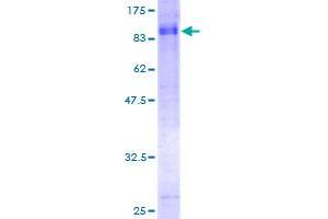 Kinesin Family Member 1B (KIF1B) (AA 1-579) protein (GST tag)