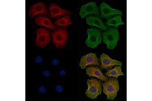 ABIN6256887 and ABIN6274764 staining Hela cells by IF/ICC. (TROVE2 抗体  (N-Term))