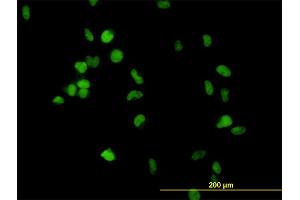 Immunofluorescence of monoclonal antibody to CSE1L on HeLa cell. (Exportin 2 抗体  (AA 872-971))