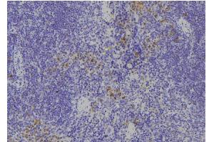 ABIN6268882 at 1/100 staining Human spleen tissue by IHC-P. (Fibronectin 1 抗体  (C-Term))