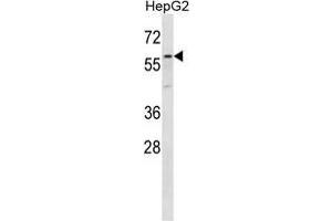 ZP4 Antibody (C-term) western blot analysis in HepG2 cell line lysates (35 µg/lane). (ZP4 抗体  (C-Term))