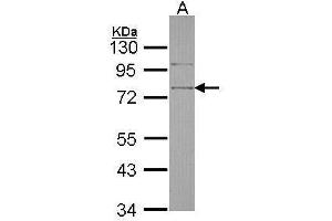 WB Image Sample (30 ug of whole cell lysate) A: Hela 10% SDS PAGE antibody diluted at 1:1000 (SRPX 抗体)