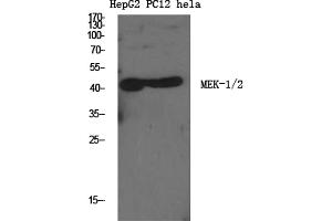 Western Blotting (WB) image for anti-Mitogen-Activated Protein Kinase Kinase 1/2 (MAP2K1/2) (Ser222), (Ser226) antibody (ABIN5961680) (MEK1/2 抗体  (Ser222, Ser226))