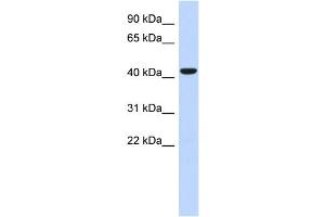 WB Suggested Anti-SGMS2 Antibody Titration: 0. (Sphingomyelin Synthase 2 抗体  (N-Term))