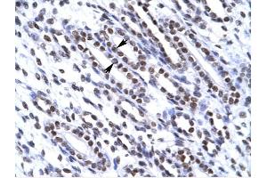 G22P1 antibody was used for immunohistochemistry at a concentration of 4-8 ug/ml to stain Epithelial cells of renal tubule (arrows) in Human Kidney. (XRCC6 抗体  (N-Term))