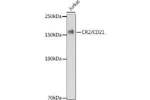 CD21 抗体