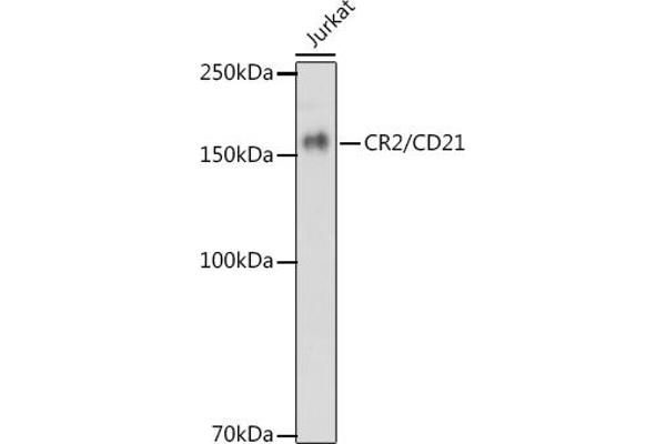 CD21 抗体