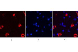 Immunofluorescence analysis of mouse brain tissue. (MAP2 抗体)