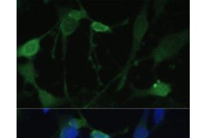 Immunofluorescence analysis of U-251 MG cells using FABP7 Polyclonal Antibody at dilution of 1:100. (FABP7 抗体)