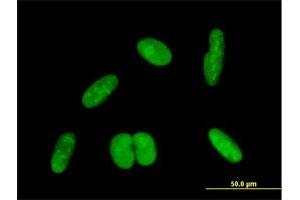 Immunofluorescence of purified MaxPab antibody to ZNF169 on HepG2 cell. (ZNF169 抗体  (AA 1-590))