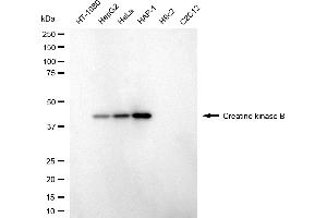 Western blotting analysis using creatine kinase B antibody (ABIN7798160). (CKB 抗体)