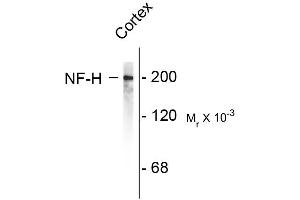 Western blots of rat cortex lysate showing specific immunolableing of the ~200k NF-H protein. (NEFH 抗体)