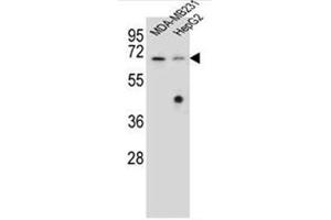 Western blot analysis of  Glomulin Antibody (C-term) in MDA-MB231, HepG2 cell line lysates (35ug/lane).