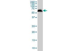 USP14 monoclonal antibody (M04), clone 6D6 Western Blot analysis of USP14 expression in HeLa . (USP14 抗体  (AA 395-494))