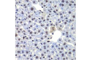 Immunohistochemistry of paraffin-embedded mouse liver using CEBPG antibody (ABIN5974381) at dilution of 1/100 (40x lens). (CEBPG 抗体)