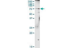 Western Blotting (WB) image for anti-UDP-N-Acetyl-alpha-D-Galactosamine:polypeptide N-Acetylgalactosaminyltransferase 4 (GalNAc-T4) (GALNT4) (AA 1-578) antibody (ABIN948722)