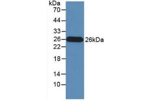 Detection of Recombinant GZMM, Human using Monoclonal Antibody to Granzyme M (GZMM) (GZMM 抗体  (AA 26-257))