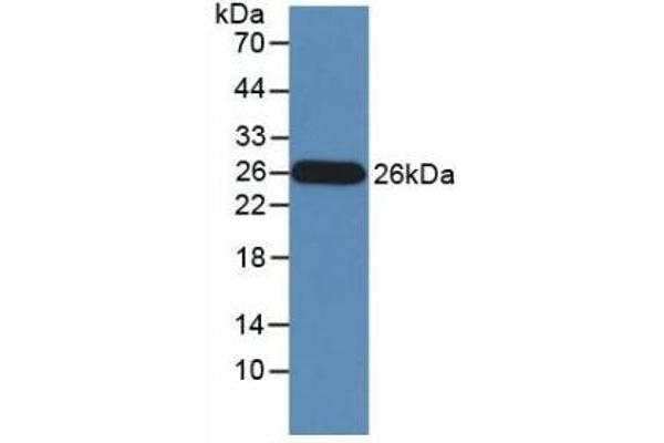 GZMM 抗体  (AA 26-257)