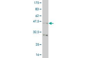 Western Blot detection against Immunogen (40. (NK2 Homeobox 5 抗体  (AA 1-130))