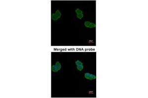 ICC/IF Image Immunofluorescence analysis of paraformaldehyde-fixed A431, using Aminoacylase-1, antibody at 1:200 dilution. (Aminoacylase 1 抗体)