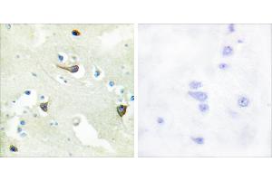 Peptide - + (EPH Receptor B1/2/3 (Internal Region) 抗体)