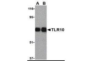 Western Blotting (WB) image for anti-Toll-Like Receptor 10 (TLR10) antibody (ABIN2479798) (TLR10 抗体)