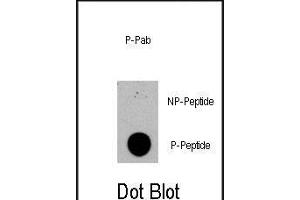 Dot blot analysis of anti-TSC2-p Phospho-specific Pab (R) on nitrocellulose membrane. (Tuberin 抗体  (pSer1420))