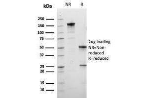 SDS-PAGE Analysis Purified Calbindin 1 Mouse Monoclonal Antibody (CALB1/3333). (CALB1 抗体  (AA 7-96))