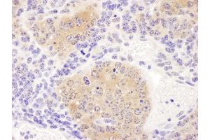 Immunohistochemistry (IHC) image for anti-Chaperonin Containing TCP1, Subunit 8 (Theta) (CCT8) (AA 398-448) antibody (ABIN7453619) (CCT8 抗体  (AA 398-448))
