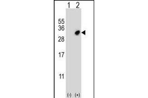 Western Blotting (WB) image for anti-Glutathione S-Transferase omega 2 (GSTO2) (AA 82-110) antibody (ABIN652022)